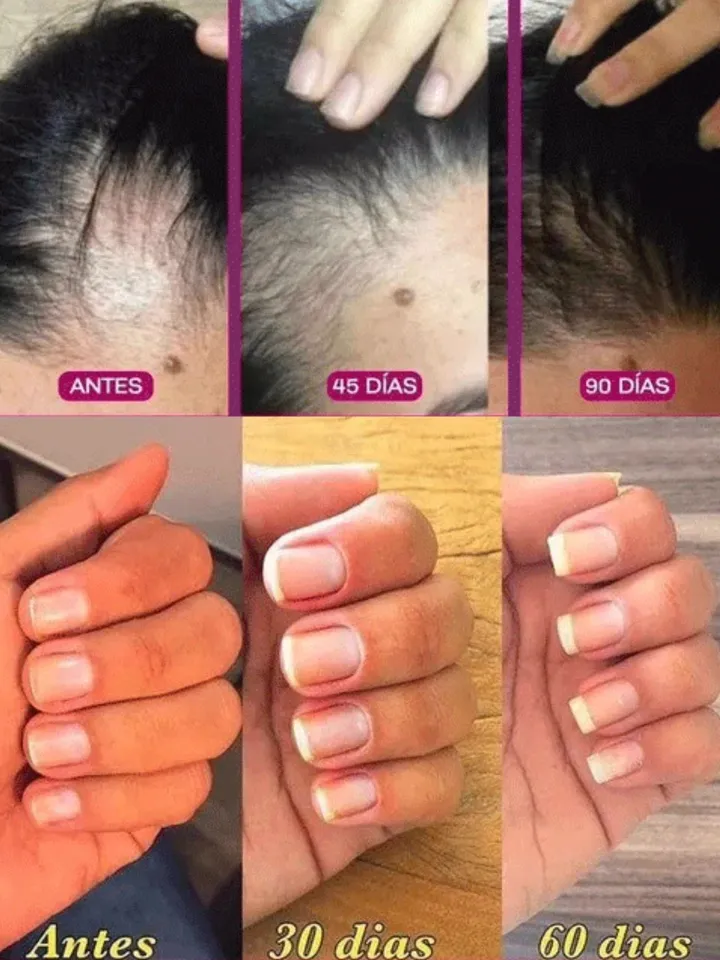 Cabello y uñas a 90 días